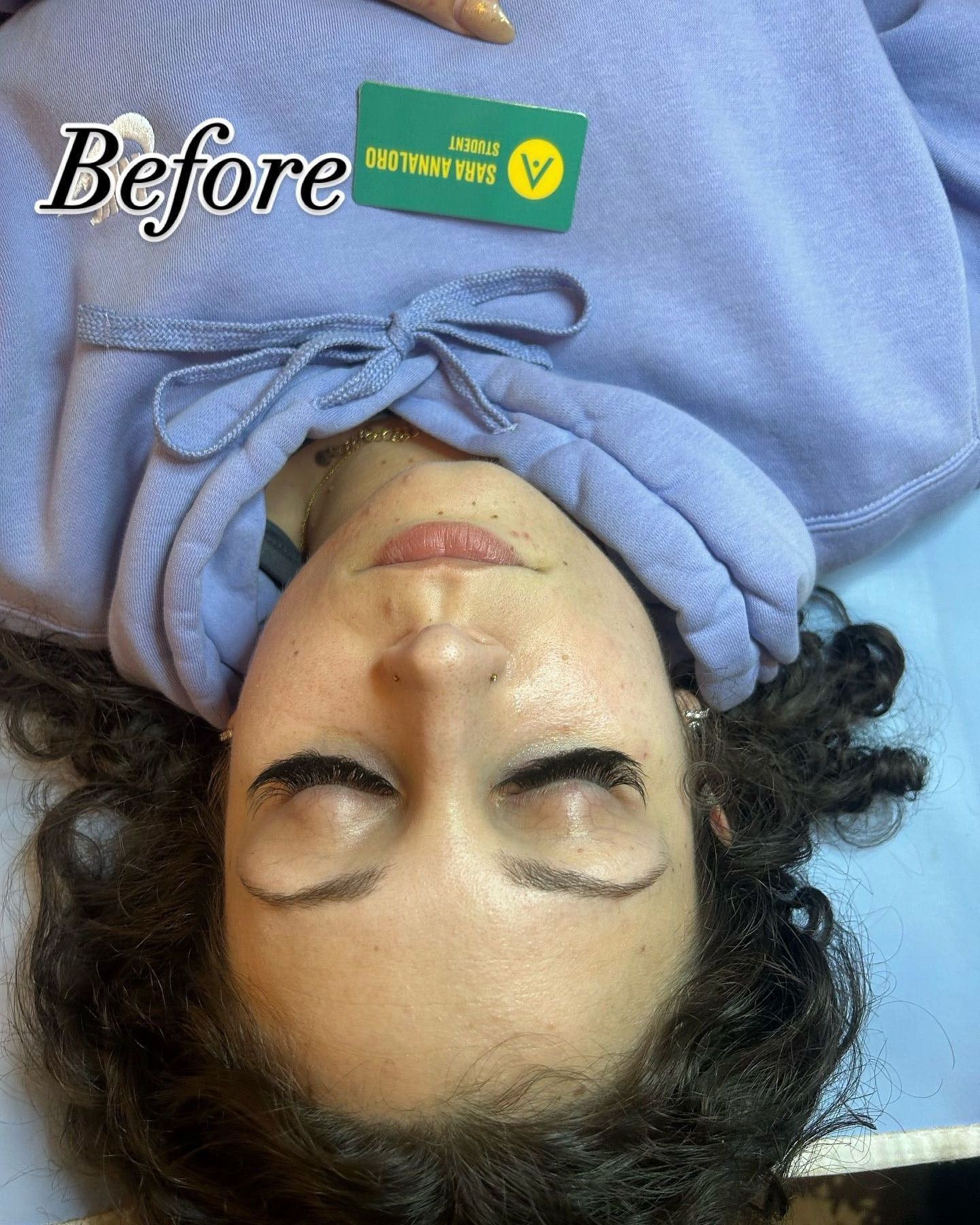 Before and after example - before